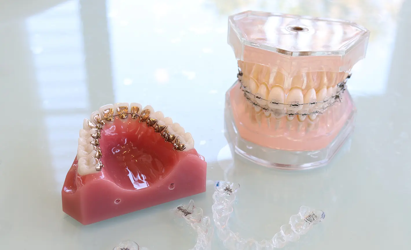 マウスピース矯正・ワイヤー矯正どちらも対応可能