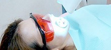 オフィスホワイトニング