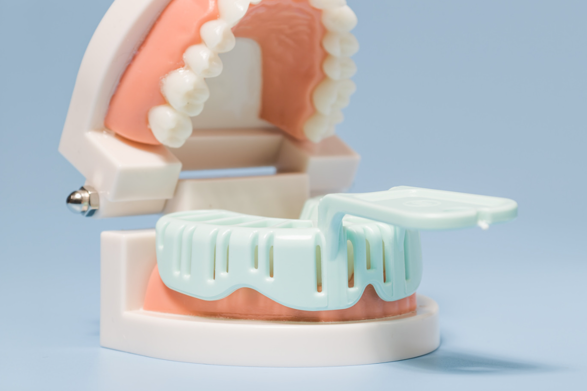 🦷歯医者で行う「型取り」って何？🦷