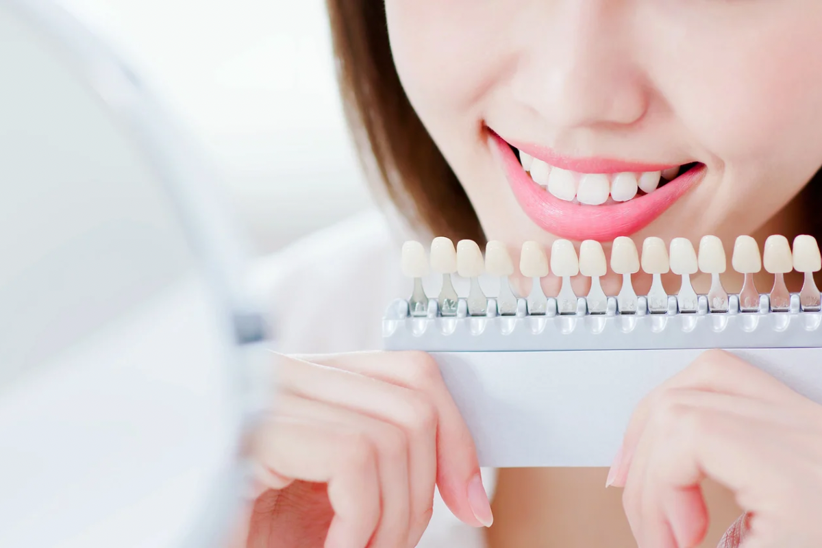 🦷短期間で白く？じっくり長持ち？オフィスホワイトニングとホームホワイトニングの違い🦷