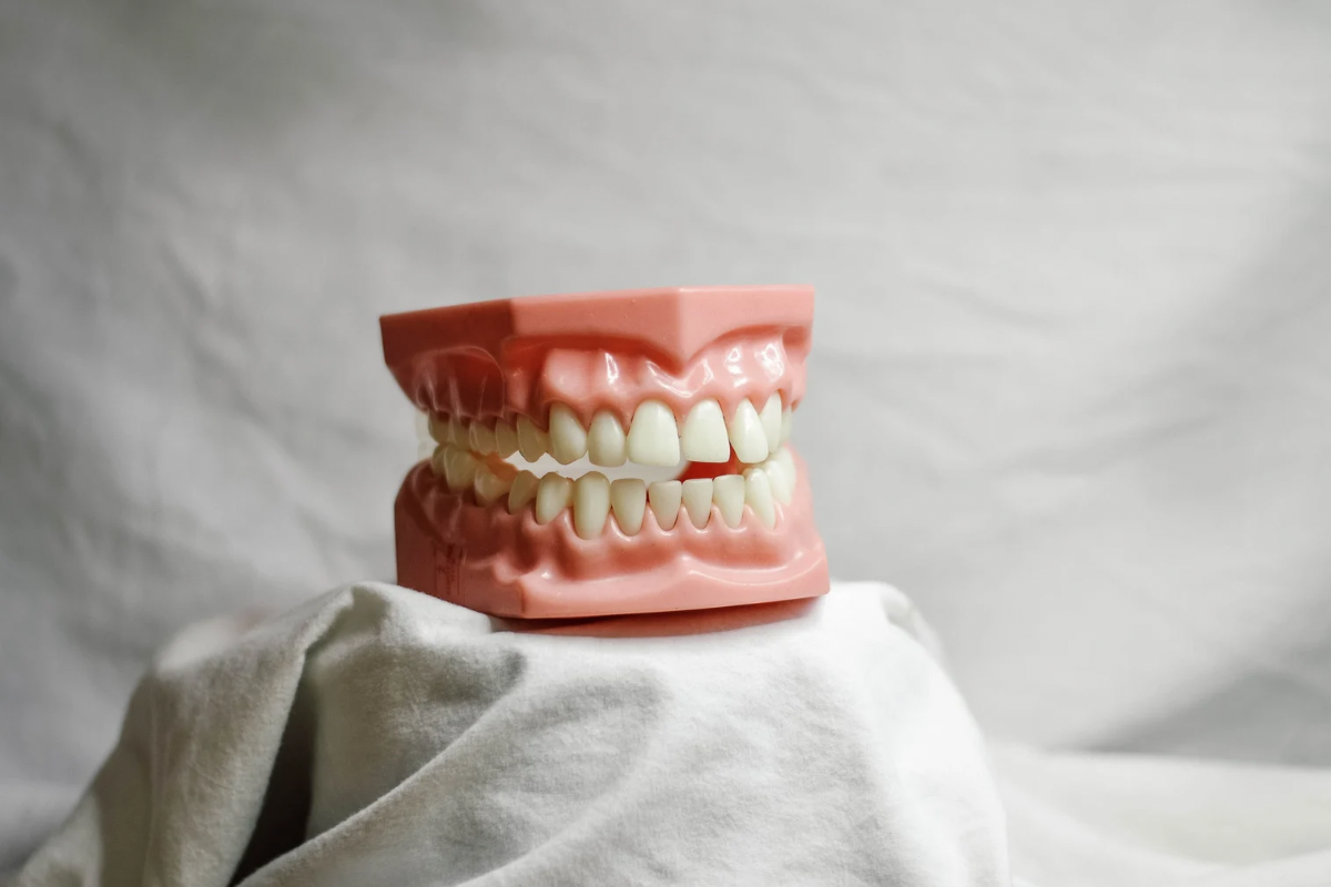 🦷歯槽膿漏とは?—放置すると危険な“歯周病の最終段階🦷